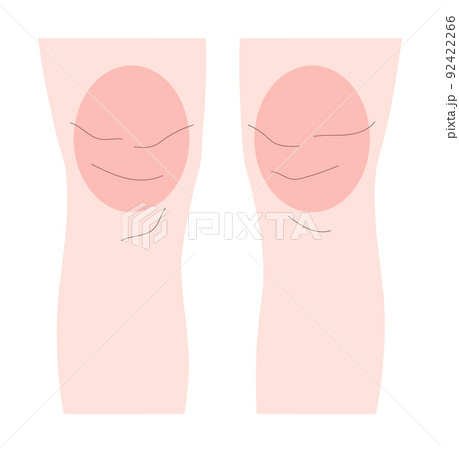 足が太い女性のイラスト素材 足が太い女性のイラスト素材 92422266