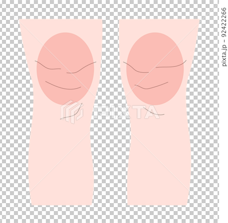 足が太い女性のイラスト素材 足が太い女性のイラスト素材 92422266