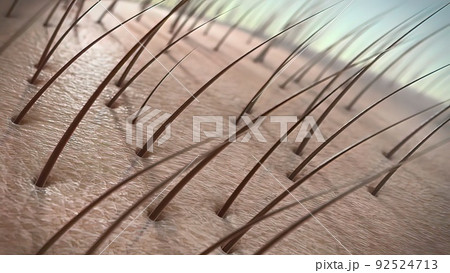 Hair follicles are small, pocket-like holes in our skin. Hair follicles are small, pocket-like holes in our skin. 92524713