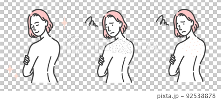 A set of young women suffering from back skin problems 92538878