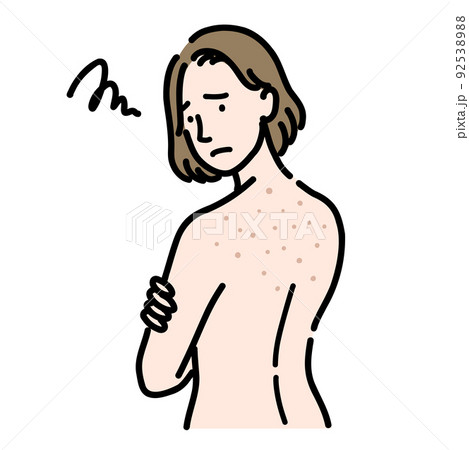 背中の肌荒れに悩んでいる若い女性 背中の肌荒れに悩んでいる若い女性 92538988