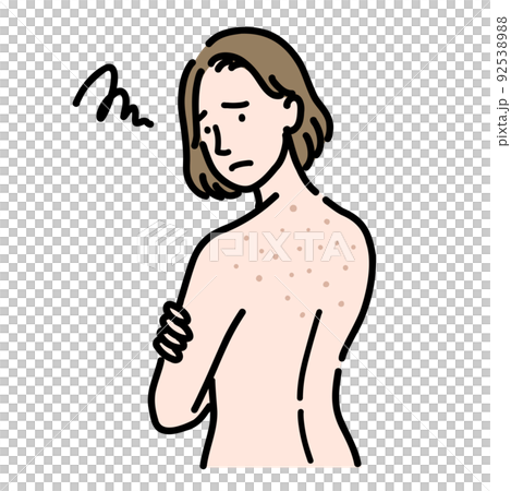 背中の肌荒れに悩んでいる若い女性 背中の肌荒れに悩んでいる若い女性 92538988