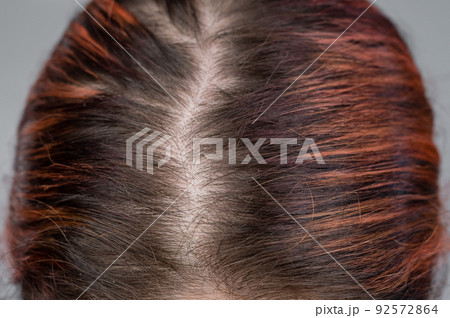Close-up of a female head parting. Close-up of a female head parting. 92572864