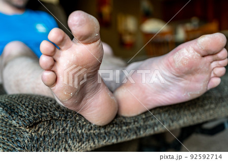 white Caucasian male with feet elevated on reclining chair 92592714