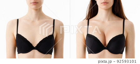 Small breasts breast augmentation female bust - Stock Illustration  [59118937] - PIXTA