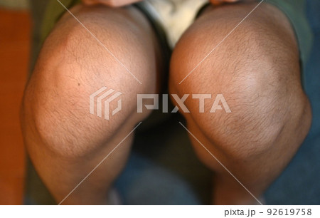 膝 膝 92619758
