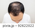 薄毛に悩む中年男性 92622022