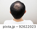 薄毛に悩む中年男性 92622023