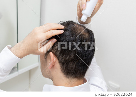 薄毛に悩む中年男性 92622024