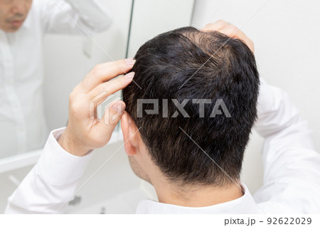 薄毛に悩む中年男性 薄毛に悩む中年男性 92622029