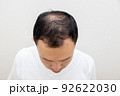 薄毛に悩む中年男性 92622030