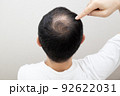薄毛に悩む中年男性 92622031