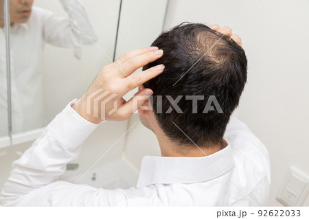 薄毛に悩む中年男性 92622033