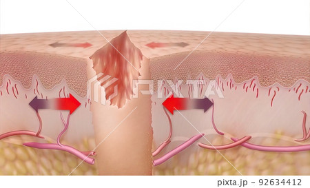 3D Medical illustration of healing time of skin wounds 3D Medical illustration of healing time of skin wounds 92634412