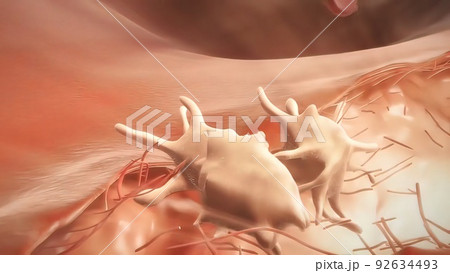 Hemophilia is a bleeding disorder that slows the blood clotting process. 92634493