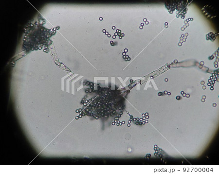 ロックフォールチーズから分離した青かび 92700004