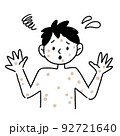 サル痘　男性　イラスト 92721640