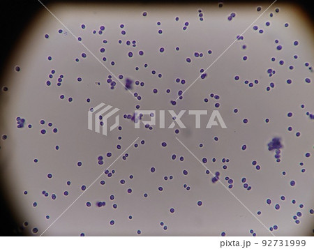 染色し見やすくした酵母菌 染色し見やすくした酵母菌 92731999