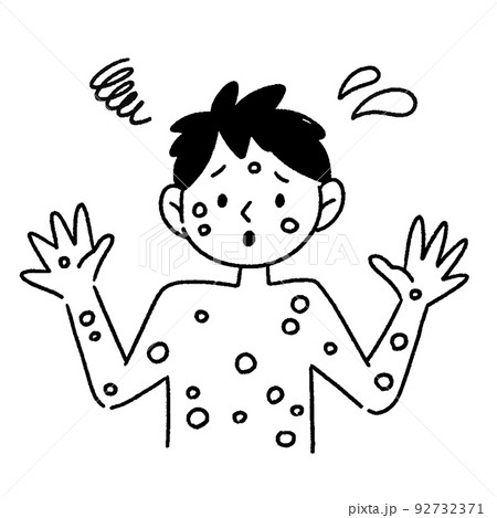 サル痘 男性 イラスト 白黒 サル痘 男性 イラスト 白黒 92732371