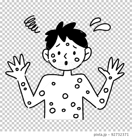 サル痘 男性 イラスト 白黒 サル痘 男性 イラスト 白黒 92732371