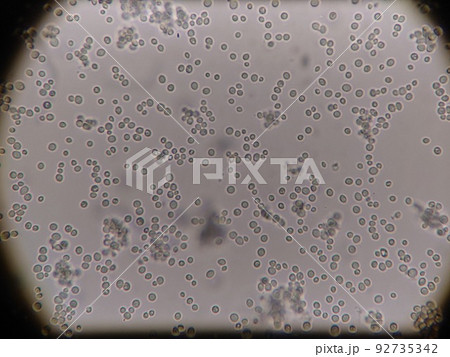十勝天然酵母の顕微鏡写真 92735342