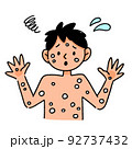 サル痘　男性　イラスト 92737432
