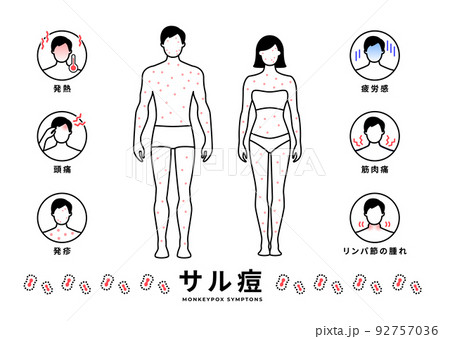 イラスト素材:サル痘 シンプルな顔と全身の症例 セット 92757036