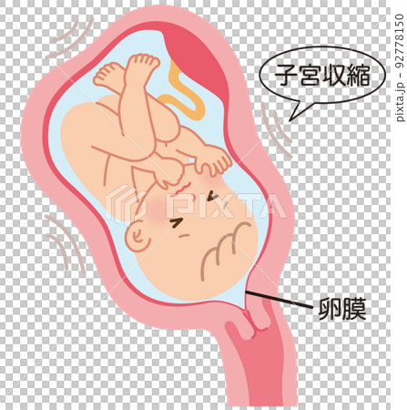 切迫早産　子宮の中の赤ちゃん　妊娠中の母体の仕組み 92778150