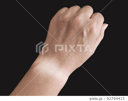 時計焼けした腕 92794415