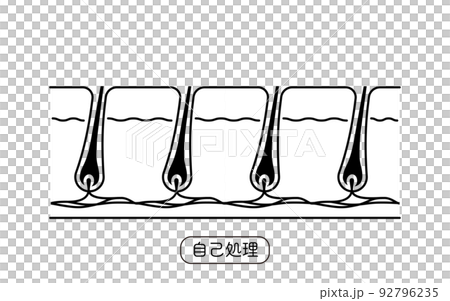 Image of hair removal, self-treatment after hair treatment 92796235