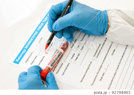 doctor in nitrile gloves fill out blood test form for monkeypox with positive result 92798965