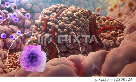 3D illustration Immune Cells Destroy Cancer Cells 3D illustration Immune Cells Destroy Cancer Cells 92800524