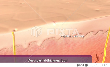 Epidermis of thin skin. From the depth to the surface it can be identified the the basale, spinosum, granulosum and corneum strata. Epidermis of thin skin. From the depth to the surface it can be identified the the basale, spinosum, granulosum and corneum strata. 92800542