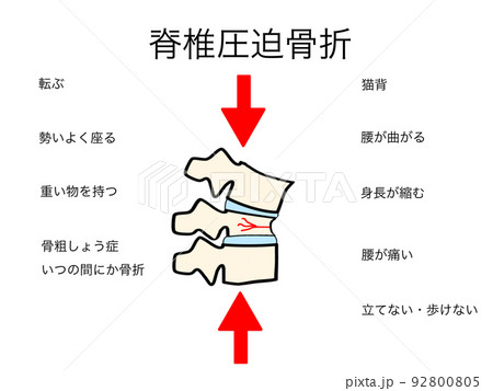 脊椎圧迫骨折のイラスト 92800805