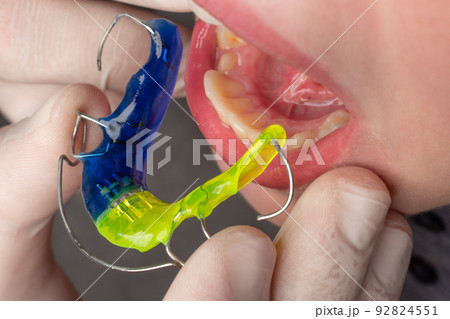 Plate for the lower teeth, orthodontic and plate for the teeth of the lower jaw. Plate for the lower teeth, orthodontic and plate for the teeth of the lower jaw. 92824551