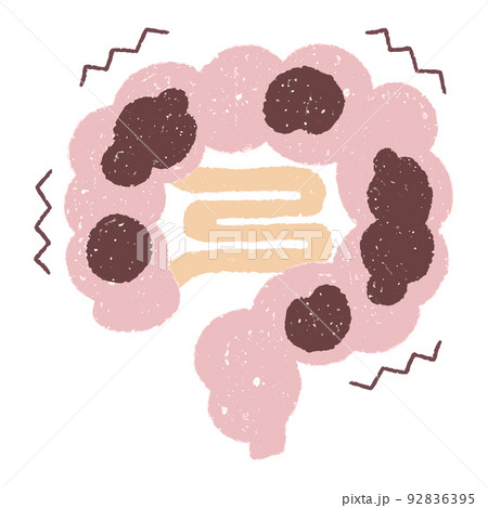 手描きの便秘 92836395