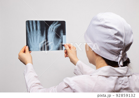 A doctor or radiologist holds an X-ray of a patient with a hand injury. Diagnosis of fractures, fractures of bones and dislocations of the joints of the arm. A doctor or radiologist holds an X-ray of a patient with a hand injury. Diagnosis of fractures, fractures of bones and dislocations of the joints of the arm. 92859132
