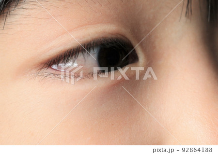 結膜浮腫 92864188