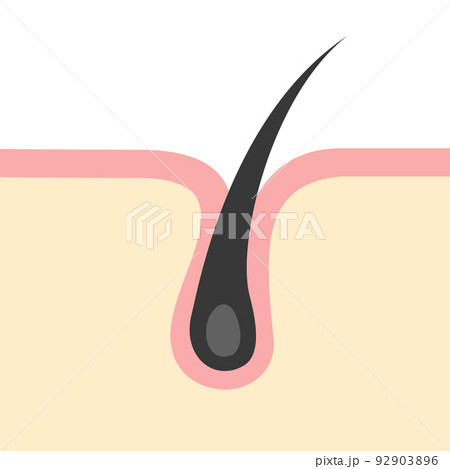 シンプルな毛根のイメージイラスト シンプルな毛根のイメージイラスト 92903896
