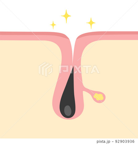 正常な毛穴のイメージイラスト 92903936