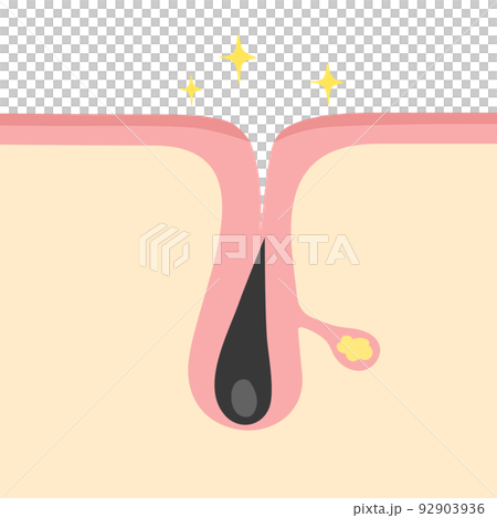 正常な毛穴のイメージイラスト 92903936