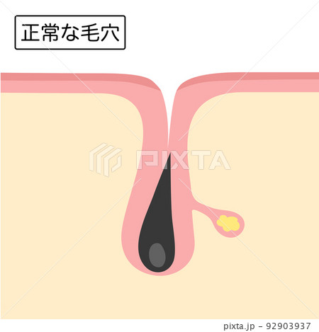 正常な毛穴のイメージイラスト 92903937