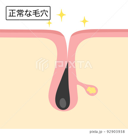 正常な毛穴のイメージイラスト 92903938