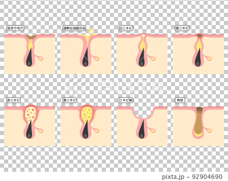 various skin problems 92904690