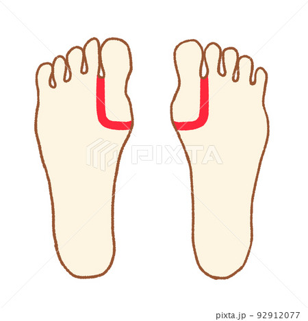 足つぼの簡単な図　甲状腺 92912077