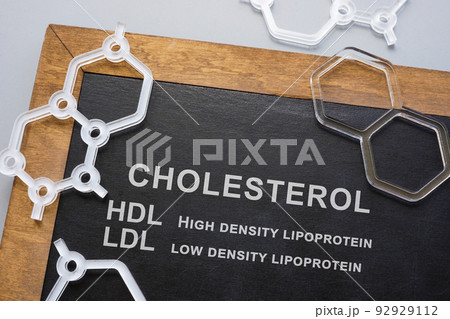 Blackboard with words cholesterol HDL and LDL. 92929112