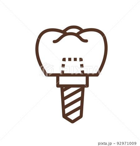 インプラント イラスト インプラント イラスト 92971009