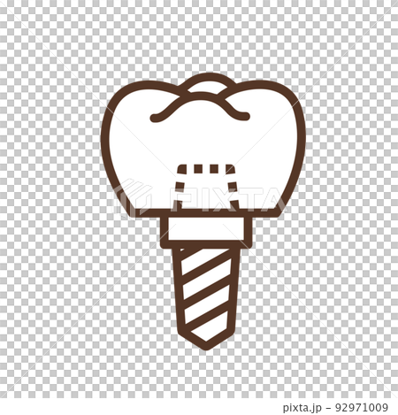 インプラント イラスト インプラント イラスト 92971009