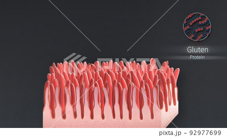 Realistic villi inside the intestines under the microscope. Realistic villi inside the intestines under the microscope. 92977699