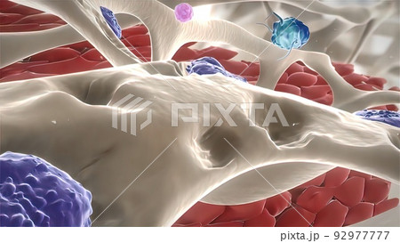 Disrupting bone structure, Rheumatoid Arthritis 92977777